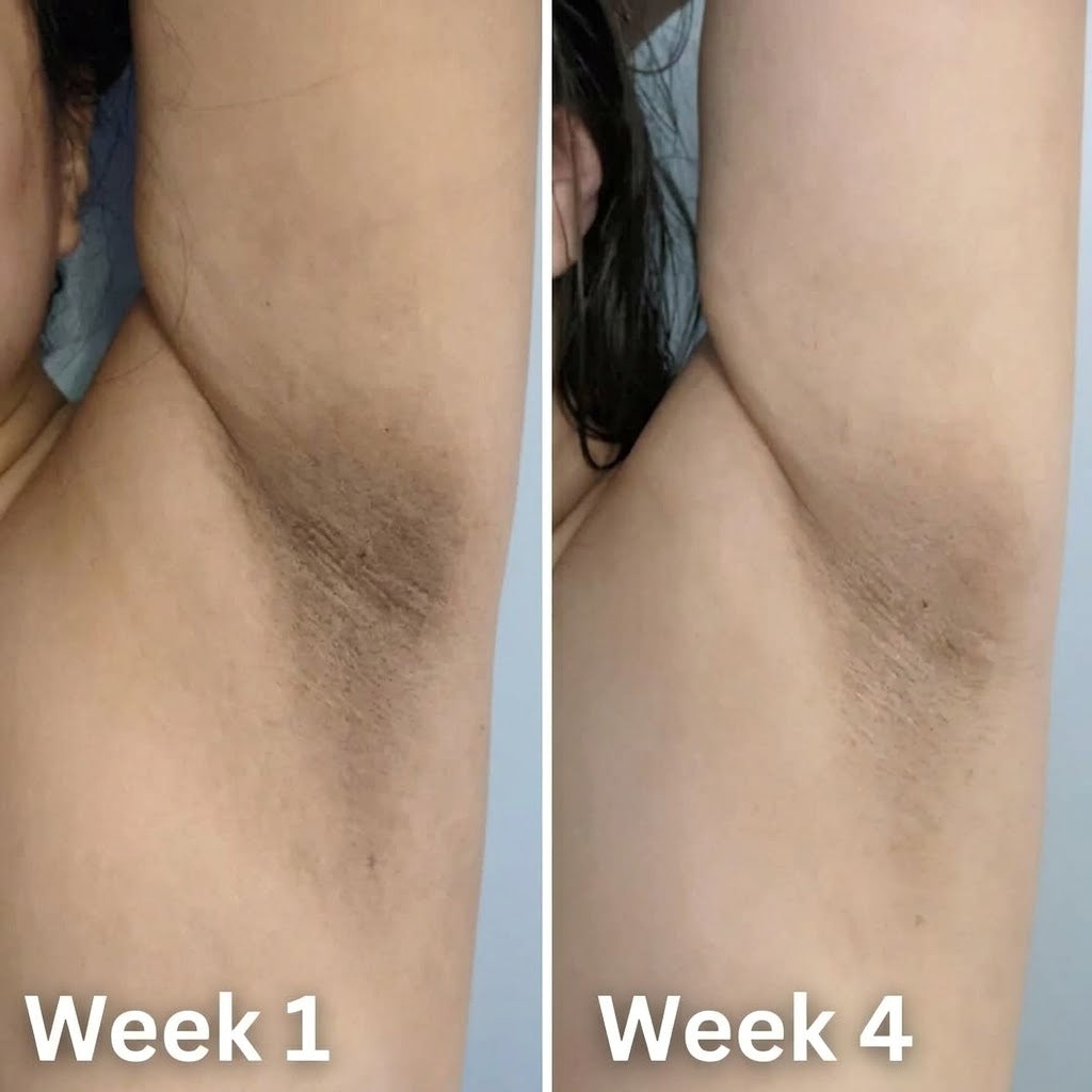 Kojic Acid & Turmeric Deodorant