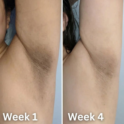 Kojic Acid & Turmeric Deodorant